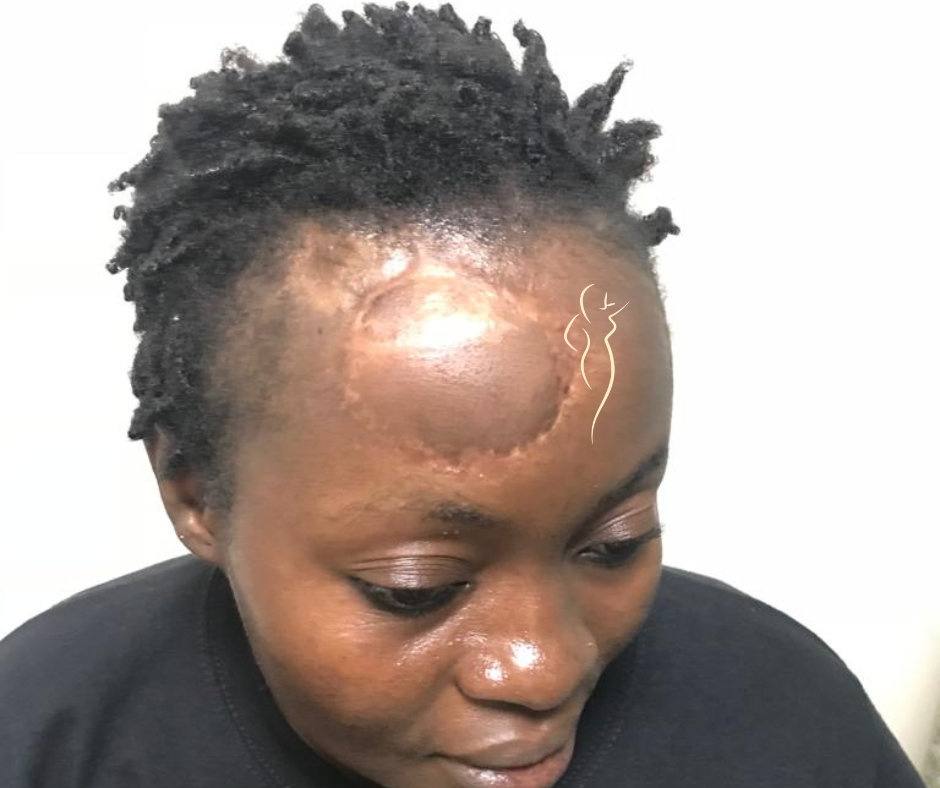 Wound Care Kenya